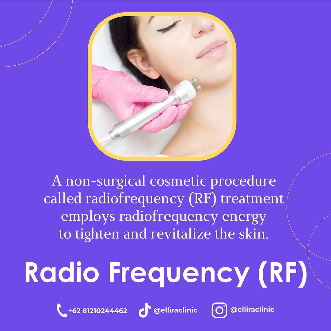 logo-Radio Frequency  (RF)